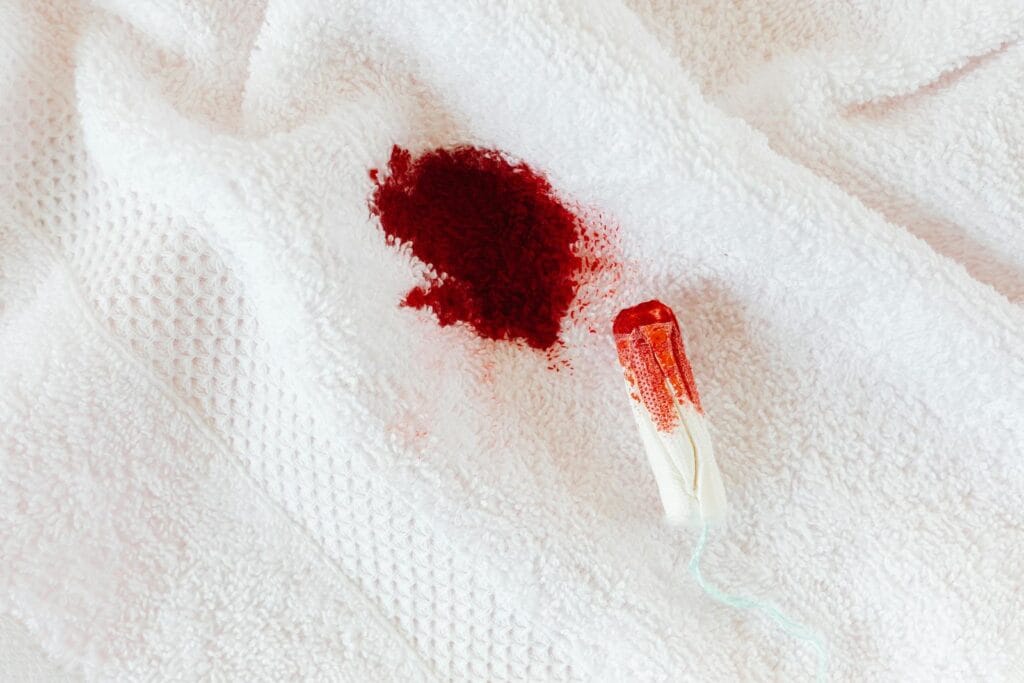 How to Wash Blood Out of Clothes